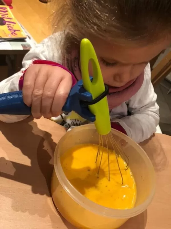Girl using the functional hand to hold a whisk and beat an egg
