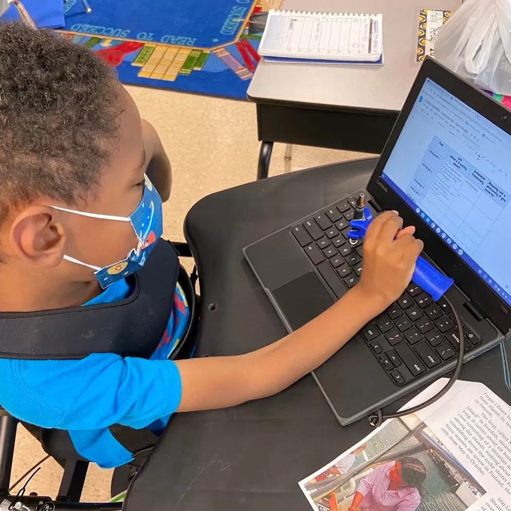 functionalhand being used by a young boy to use a laptop keyboard