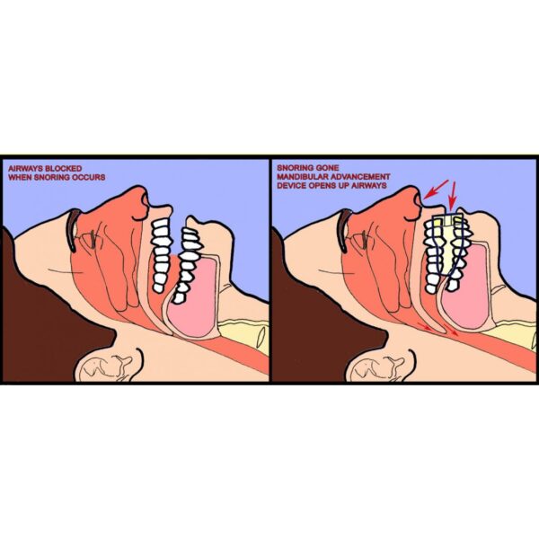 Image showing the snoringone in a mans mouth.