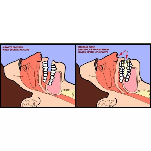 Image showing the snoringone in a mans mouth.